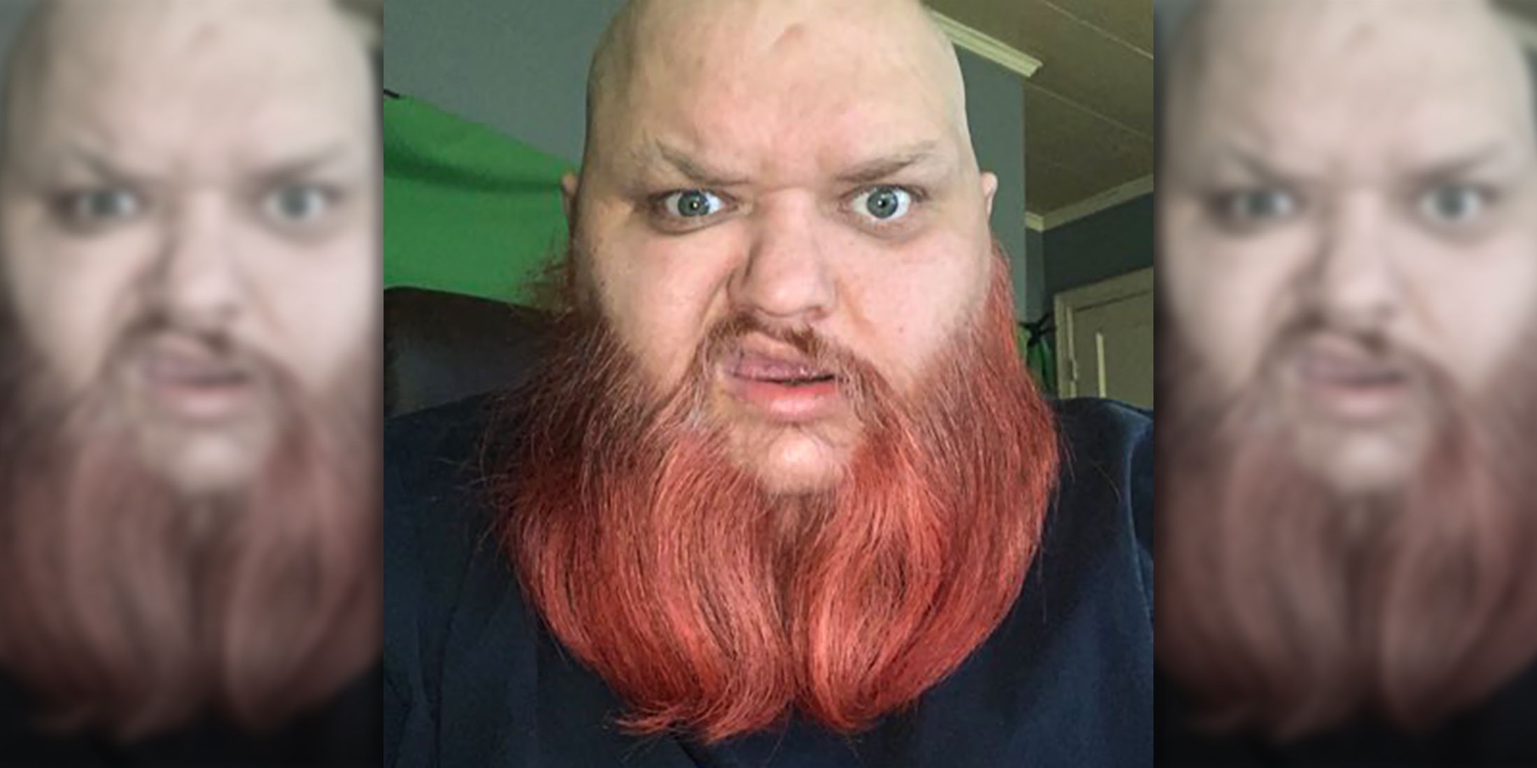 TikTok Creator KingBeardX Passes Away at 47